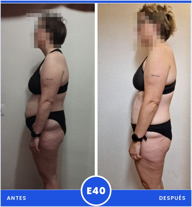 Antes y despues de una clienta del programa