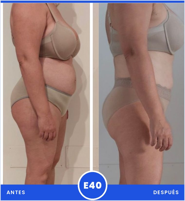 Antes y despues de una clienta del programa